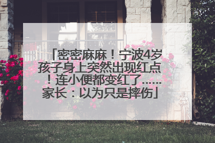 密密麻麻！宁波4岁孩子身上突然出现红点！连小便都变红了……家长：以为只是摔伤